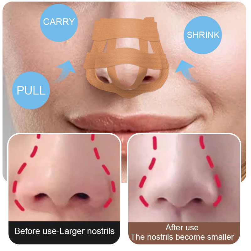 Beauty Nose Up Lifting Bridge  - Nose Trimmer review and price