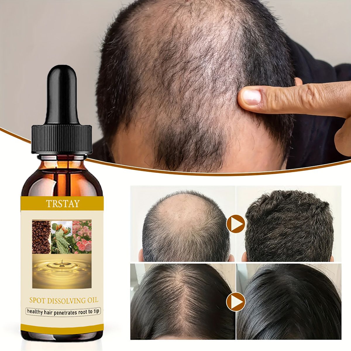 50ML Beard Growth Oil Anti Alo - Beard Oil review and price